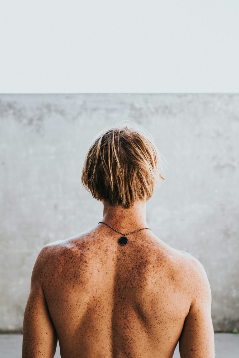 skin cancer